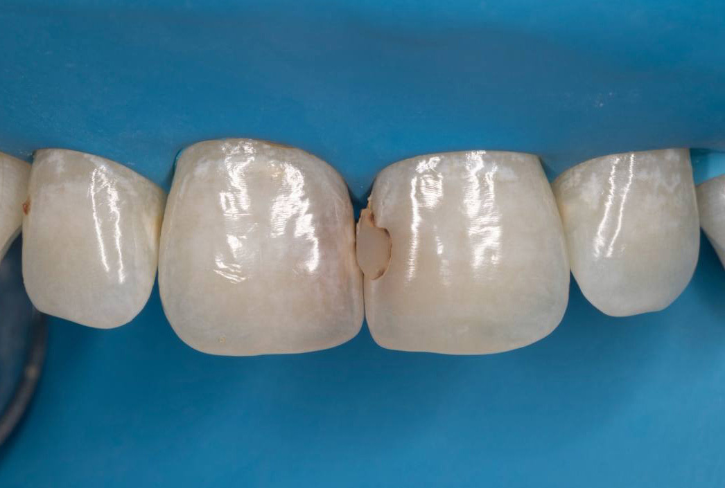 estetica-1d estetica-1d